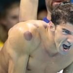 Você sabe o que são as manchas no Michael Phelps?